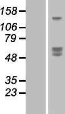 Western Blot: SIRP beta 1/CD172b Overexpression Lysate [NBP2-07675]