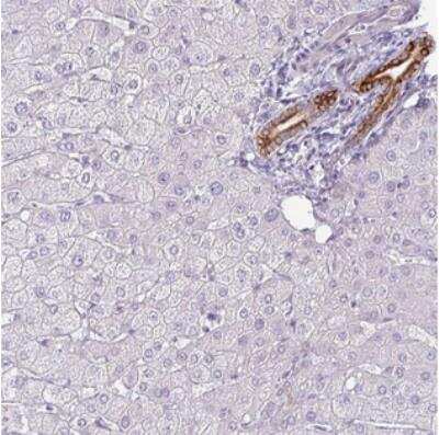 Immunohistochemistry-Paraffin: SIRPB2 Antibody [NBP2-30768]