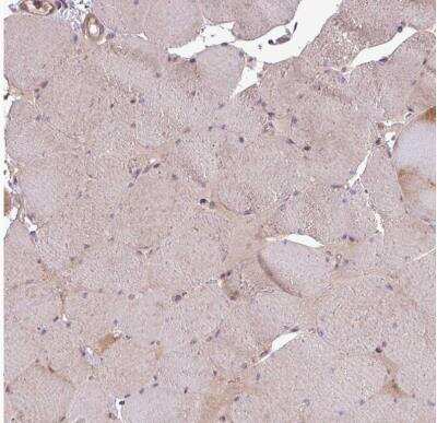 Immunohistochemistry-Paraffin: SIRPB2 Antibody [NBP2-33512]