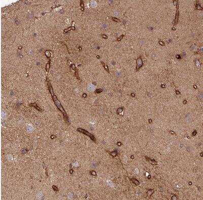 Immunohistochemistry-Paraffin: SIRPB2 Antibody [NBP2-33512]