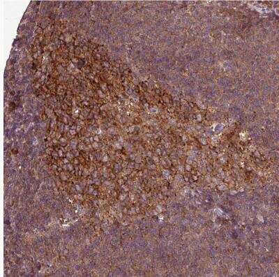 Immunohistochemistry-Paraffin: SIRPB2 Antibody [NBP2-33512]