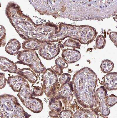 Immunohistochemistry-Paraffin: SIRPB2 Antibody [NBP2-33512]