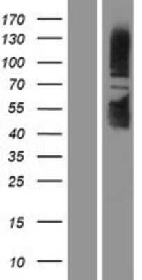 Western Blot: Sirtuin 1/SIRT1 Overexpression Lysate [NBP2-04329]