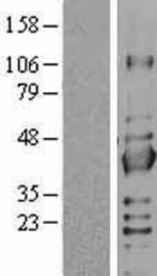 Western Blot: Sirtuin 2/SIRT2 Overexpression Lysate [NBL1-15974]