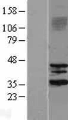 Western Blot: Sirtuin 3/SIRT3 Overexpression Lysate [NBL1-15975]