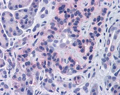 Immunohistochemistry: SIRT4 Antibody [NBP1-80002]