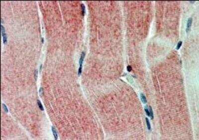 Immunohistochemistry-Paraffin: SIRT4 Antibody [NB100-1406]