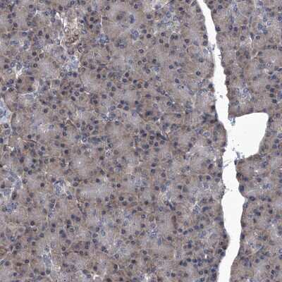 Immunohistochemistry-Paraffin: SIRT4 Antibody [NBP1-80746]