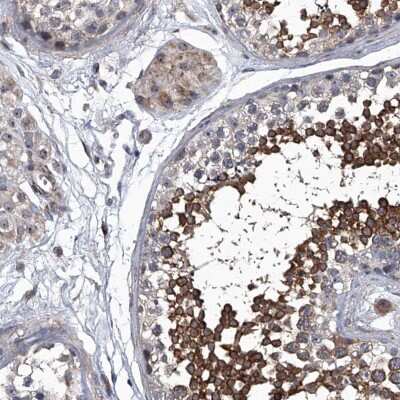 Immunohistochemistry-Paraffin: SIRT4 Antibody [NBP1-80746]