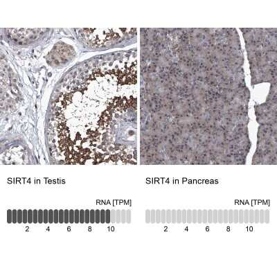 Immunohistochemistry-Paraffin: SIRT4 Antibody [NBP1-80746]
