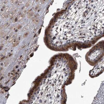 Immunohistochemistry-Paraffin: SIRT4 Antibody [NBP1-80747]