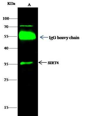 Immunoprecipitation: SIRT4 Antibody [NBP2-98856]