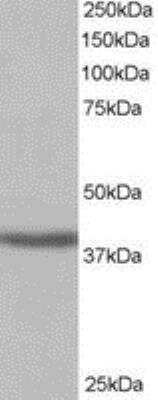 Western Blot: SIRT4 Antibody [NB100-1406]