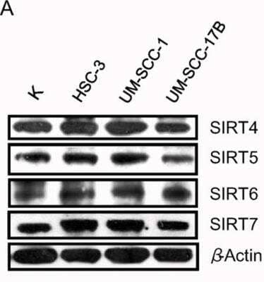 Western Blot: SIRT4 Antibody [NB100-1406]