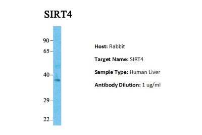 Western Blot: SIRT4 Antibody [NBP1-80002]