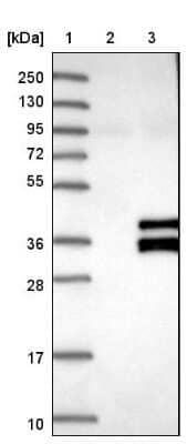 Western Blot: SIRT4 Antibody [NBP1-80746]