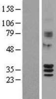 Western Blot: SIRT4 Overexpression Lysate [NBL1-15977]