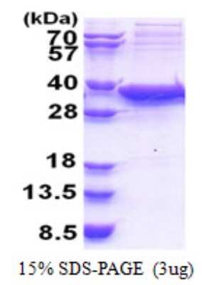 SDS-PAGE: Recombinant Human Sirtuin 5/SIRT5 His Protein [NBP2-22807]