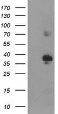 Western Blot: SIRT6 Antibody (OTI1G3) [NBP2-01310]