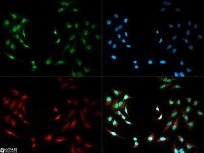 Immunocytochemistry/ Immunofluorescence: SIRT6 Antibody [NB100-2524]