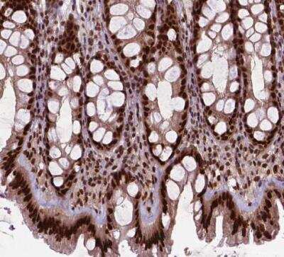 Immunohistochemistry-Paraffin: SIRT6 Antibody [NBP2-49668]