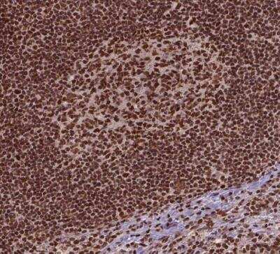 Immunohistochemistry-Paraffin: SIRT6 Antibody [NBP2-49668]