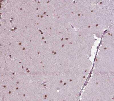 Immunohistochemistry-Paraffin: SIRT6 Antibody [NBP2-49668]