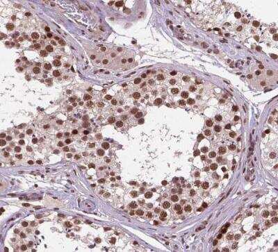 Immunohistochemistry-Paraffin: SIRT6 Antibody [NBP2-49668]