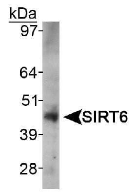 Western Blot: SIRT6 Antibody [NB100-2523]