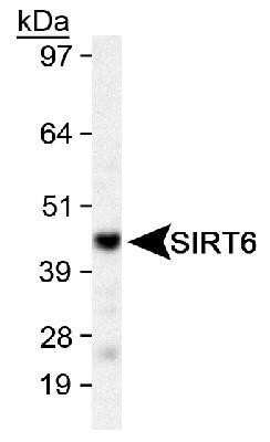 Western Blot: SIRT6 Antibody [NB100-2524]