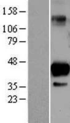 Western Blot: SIRT6 Overexpression Lysate [NBL1-15979]
