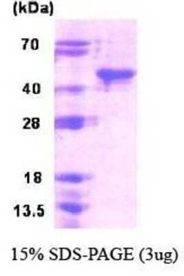 SDS-PAGE: Recombinant Human SIRT6 His Protein [NBC1-18433]