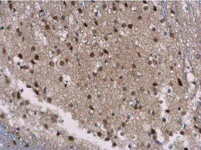 Immunohistochemistry-Paraffin: SIRT7 Antibody [NBP2-20375]