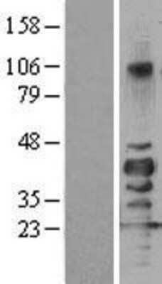 Western Blot: SIRT7 Overexpression Lysate [NBL1-15980]