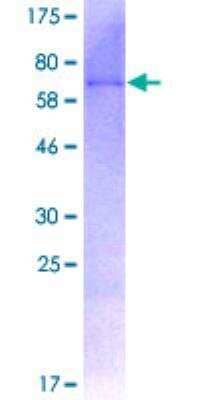 SDS-PAGE: Recombinant Human SIRT7 GST (N-Term) Protein [H00051547-P01]