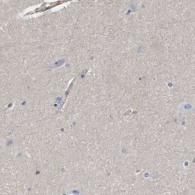 Immunohistochemistry-Paraffin: SIT1 Antibody [NBP2-13311]