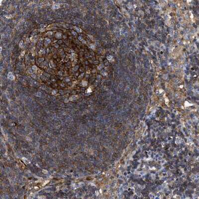 Immunohistochemistry-Paraffin: SIT1 Antibody [NBP2-13311]