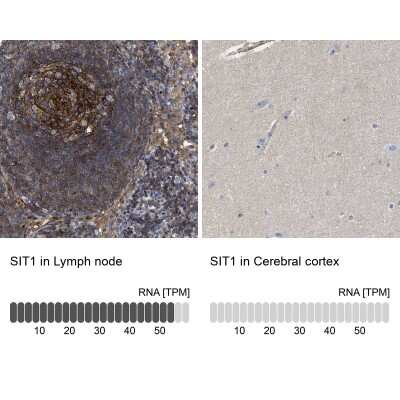 Immunohistochemistry-Paraffin: SIT1 Antibody [NBP2-13311]