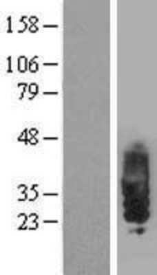 Western Blot: SIT1 Overexpression Lysate [NBP2-07336]