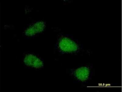 Immunocytochemistry/ Immunofluorescence: SIVA Antibody [H00010572-B01P]