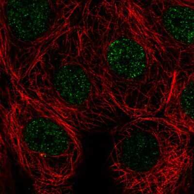 Immunocytochemistry/ Immunofluorescence: SIVA Antibody [NBP2-56374]