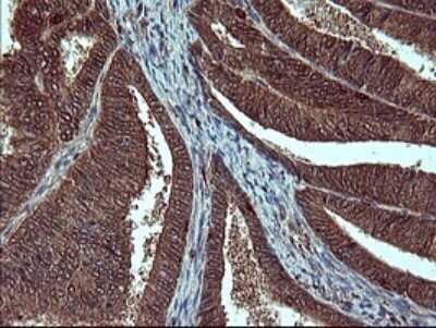 Immunohistochemistry: SIVA Antibody (OTI2F8) - Azide and BSA Free [NBP2-74208]