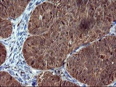 Immunohistochemistry: SIVA Antibody (OTI2F8) - Azide and BSA Free [NBP2-74208]