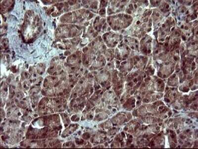 Immunohistochemistry: SIVA Antibody (OTI2F8) [NBP2-45850]
