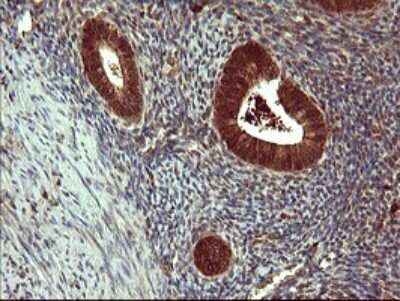 Immunohistochemistry: SIVA Antibody (OTI2F8) [NBP2-45850]