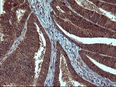 Immunohistochemistry: SIVA Antibody (OTI2F8) [NBP2-45850]