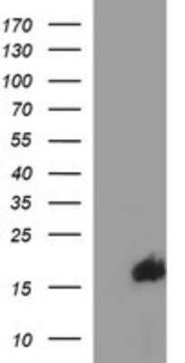 Western Blot: SIVA Antibody (OTI2F8) [NBP2-45850]