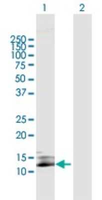 Western Blot: SIVA Antibody [H00010572-B01P]