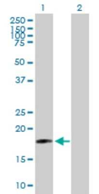 Western Blot: SIVA Antibody [H00010572-B02P]