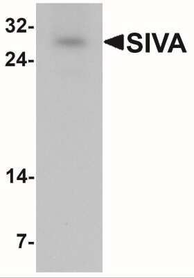 Western Blot: SIVA AntibodyBSA Free [NBP2-41150]